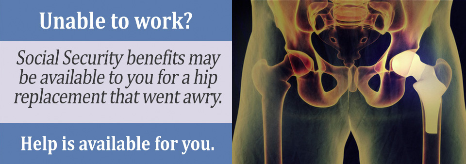 You may qualify for Social Security disability benefits if you cannot work because of a hip replacement.