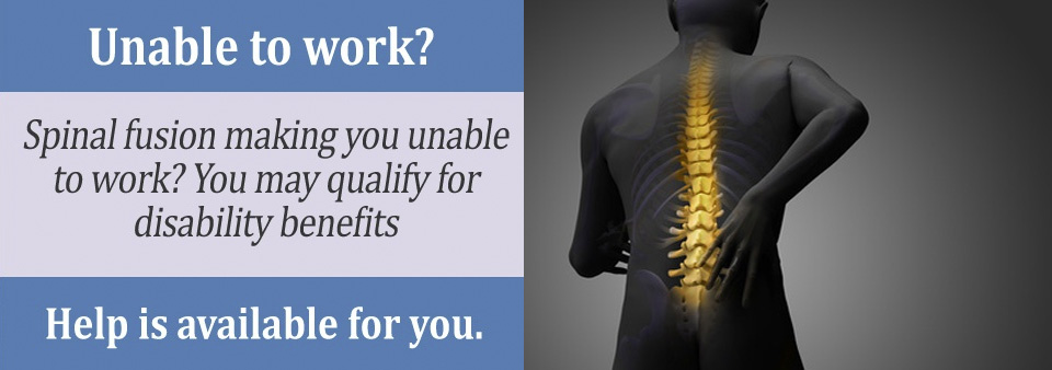 Is spinal fusion a permanent disability?